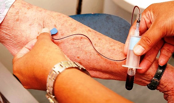  Alzheimer’ı Teşhis Eden Kan Testi Geliştirdi