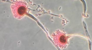 Deadly fungus that 'eats you from the inside out' invades US
