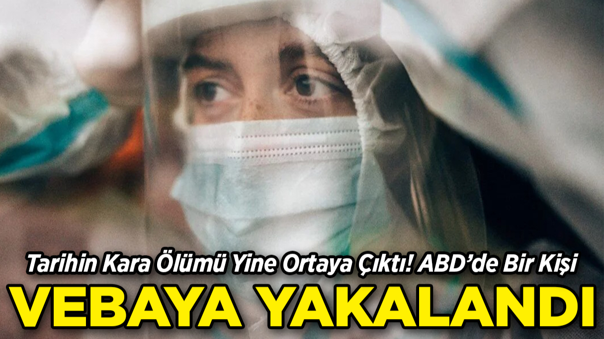 ABD’de Bir Kişide Veba Tespit Edildi!