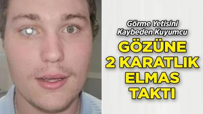 Görme Yetisini Kaybeden Kuyumcu Gözüne 2 Karatlık Elmas Taktı