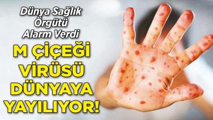 DSÖ Uyardı: M Çiçeği Virüsü Dünyaya Yayılıyor!