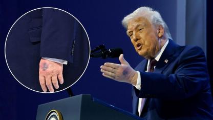 Donald Trump’ın moraran eli yeniden tartışma yarattı