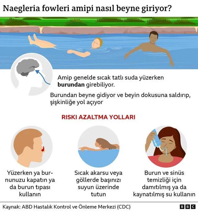 ABD'de dehşet! Su kaydırağından kaydı, 7 gün sonra hayatını kaybetti: Nedeni herkesi korkuttu