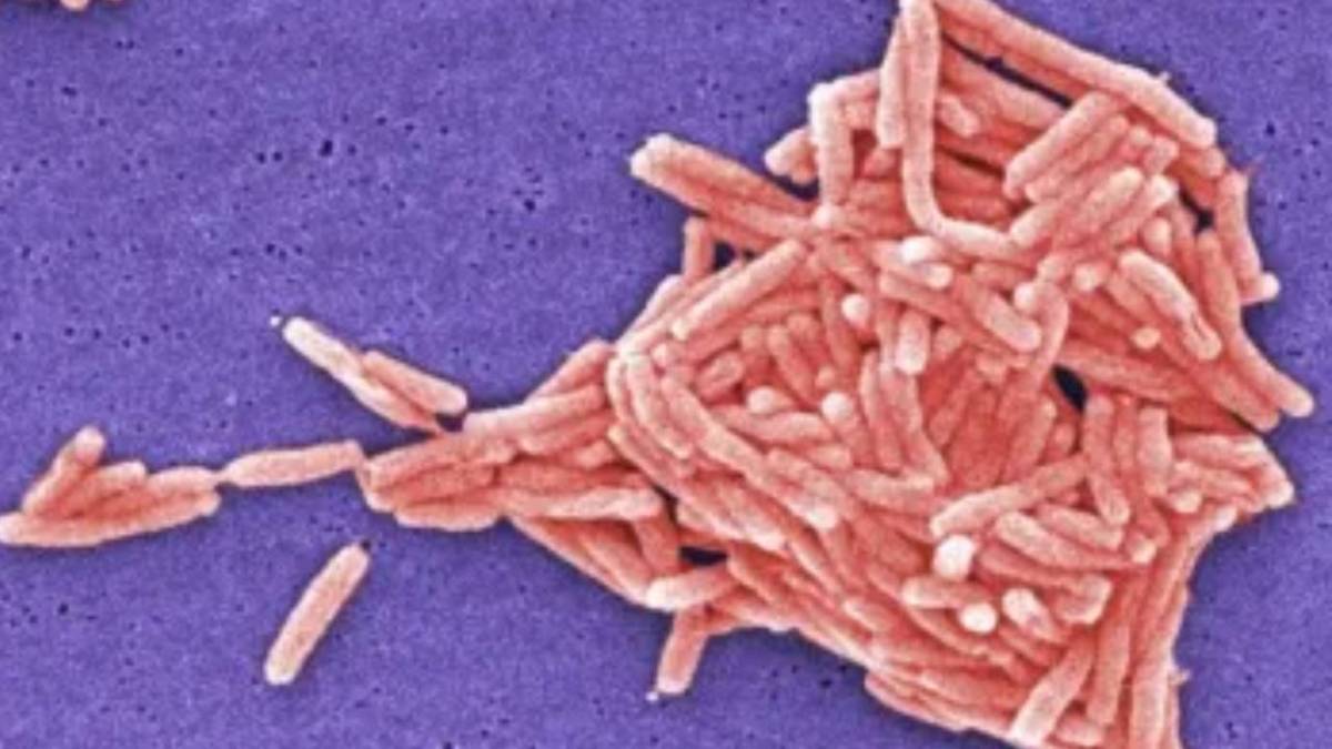 New York'ta Legionella alarmı! 31 bina inceleme altında